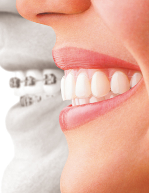 矯正専門クリニックだからお子さま～成人まで幅広い症状に対応可能