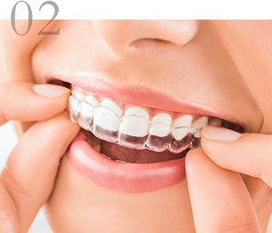 取り外しが可能