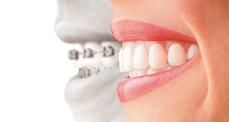 矯正専門クリニックだからお子さま~成人まで幅広い症状に対応可能