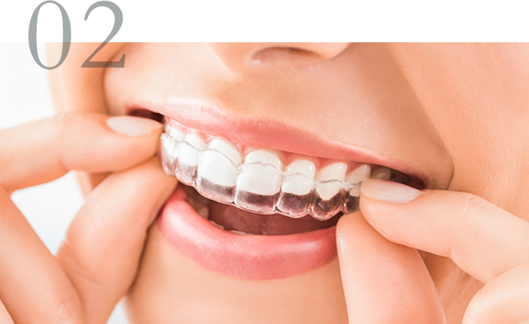 取り外しが可能